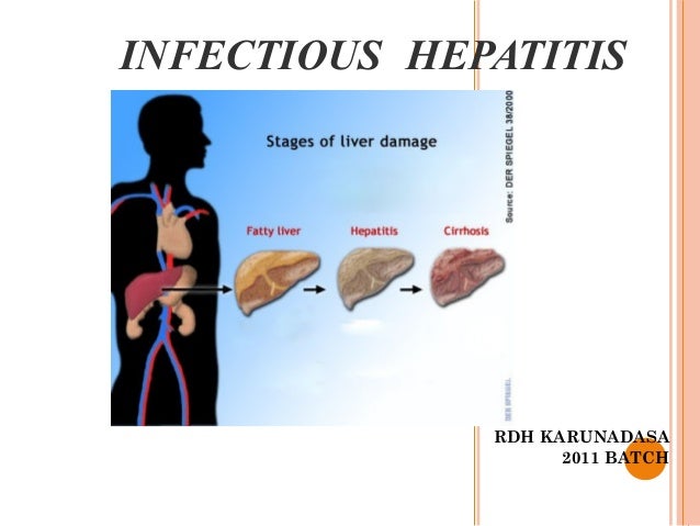 types of hepatitis Infectious hepatitis